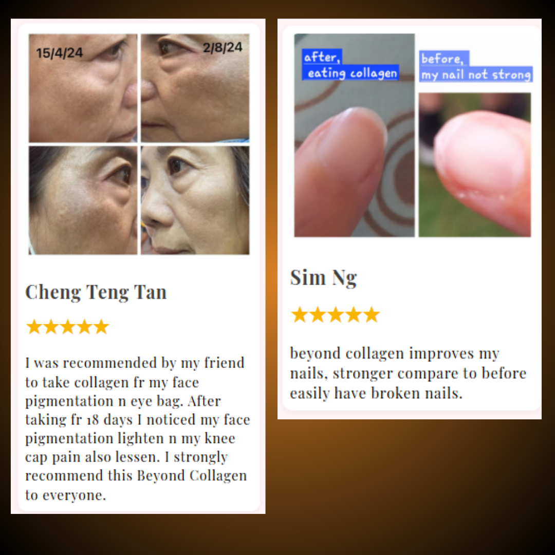 Beyond Collagen+ 7,500mg x 30 bottles