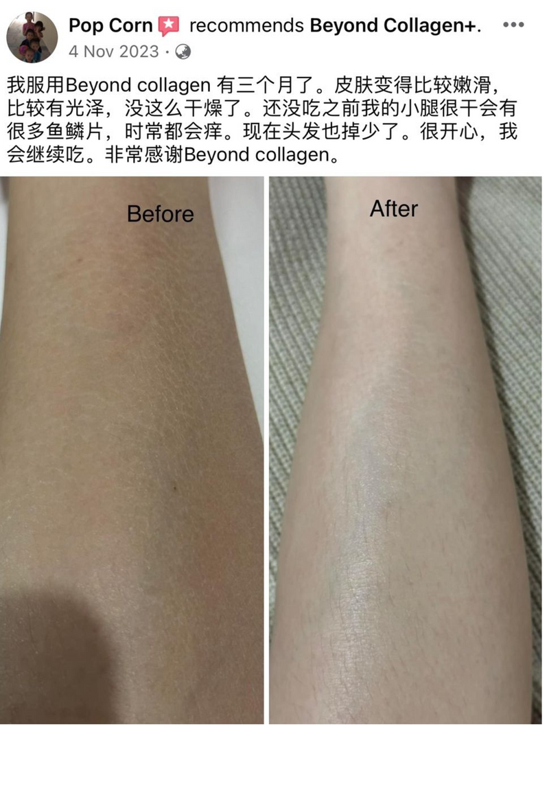 Body & Skin — Beyond Collagen+ testimonial