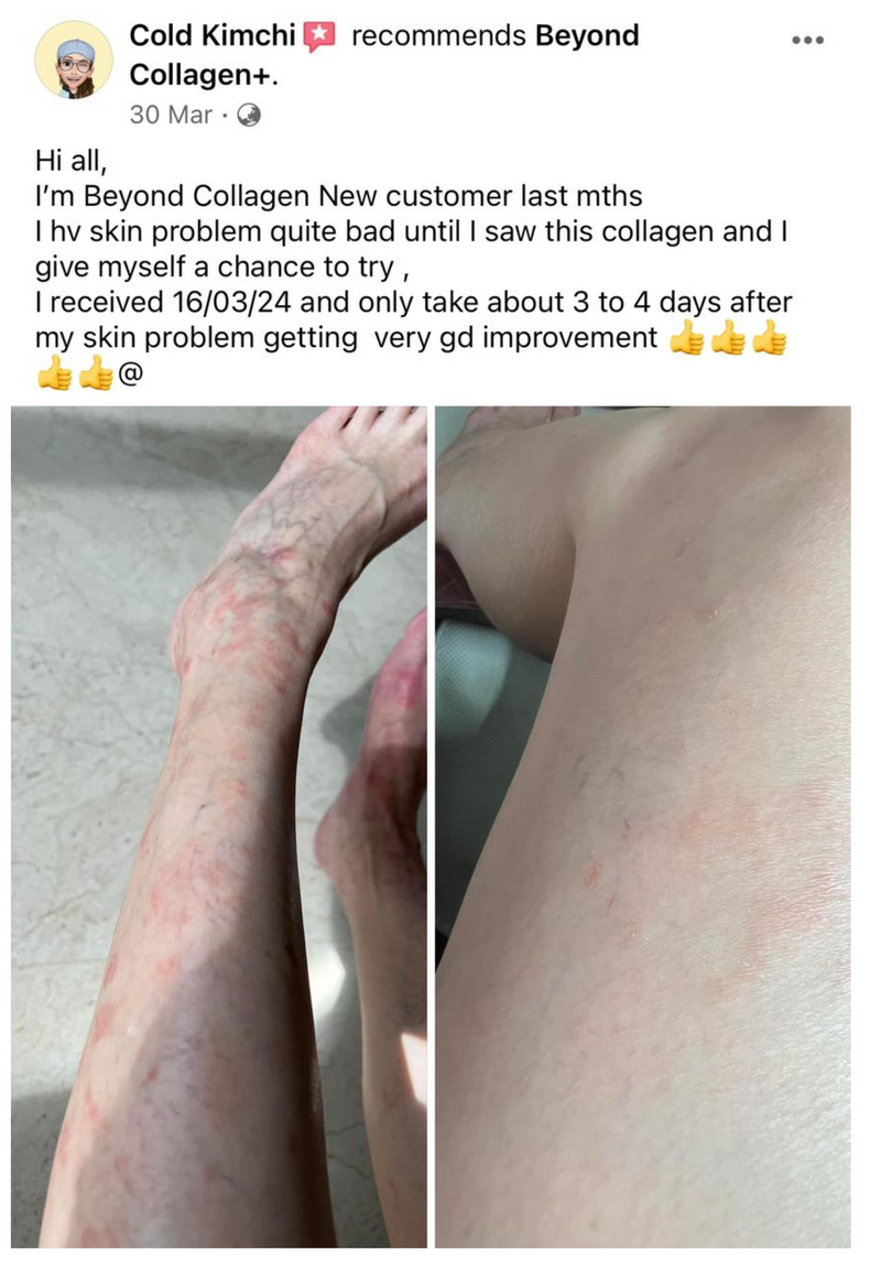 Body & Skin — Beyond Collagen+ testimonial