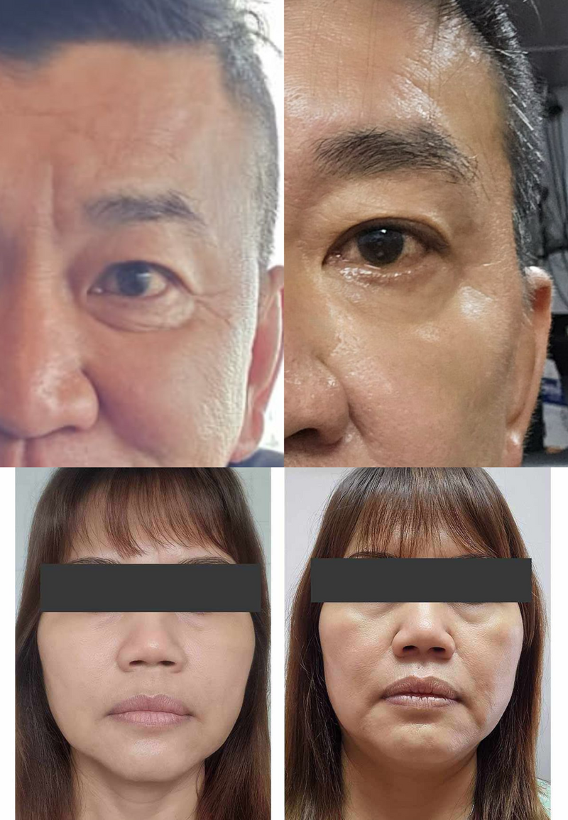 Dark Circles & Eye Bags — Beyond Collagen+ testimonial