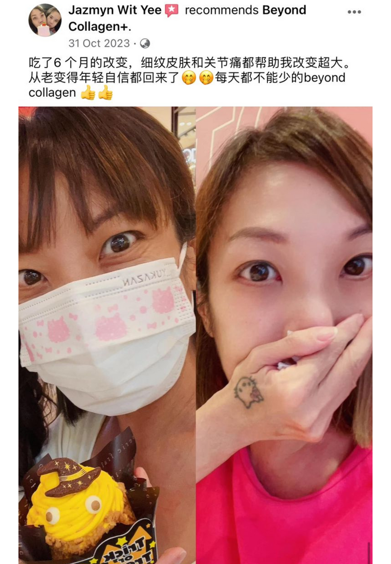 Dark Circles & Eye Bags — Beyond Collagen+ testimonial