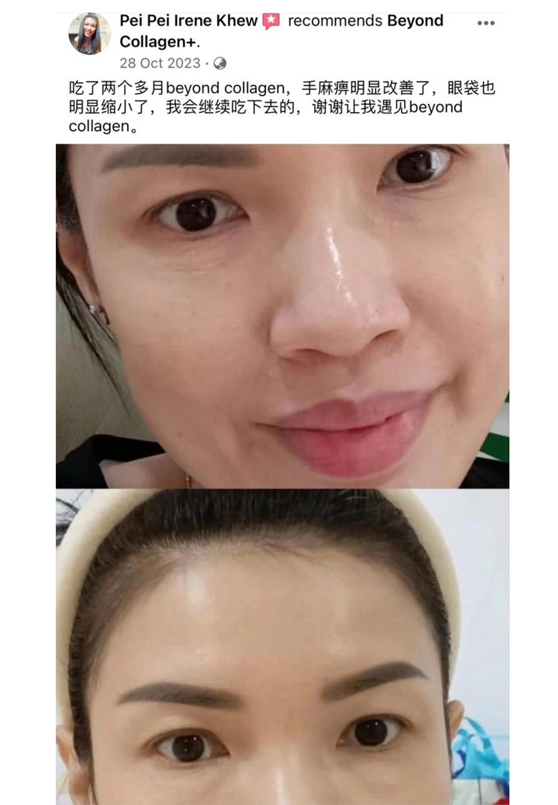 Dark Circles & Eye Bags — Beyond Collagen+ testimonial