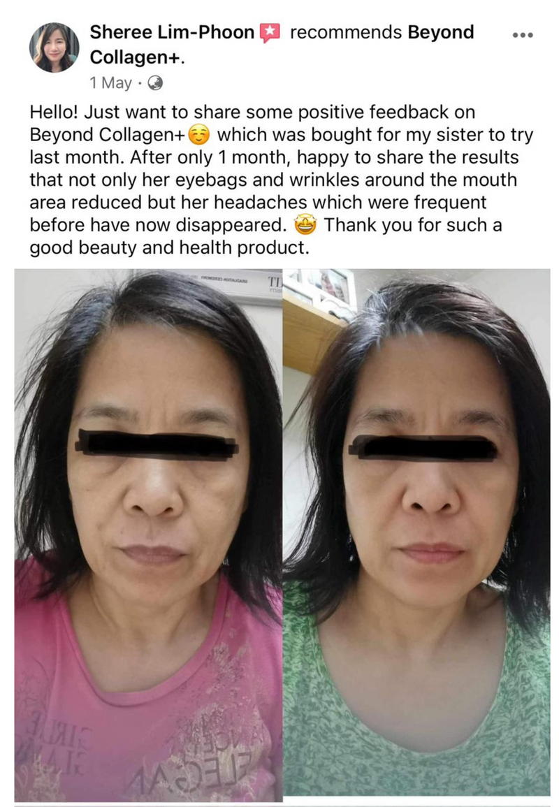 Dark Circles & Eye Bags — Beyond Collagen+ testimonial