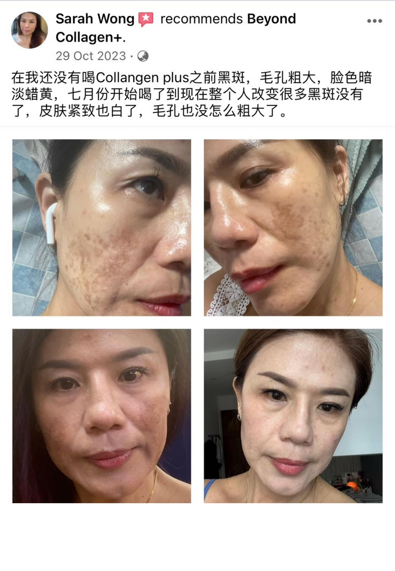 Dark Spots, Scars & Rashes — Beyond Collagen+ testimonial