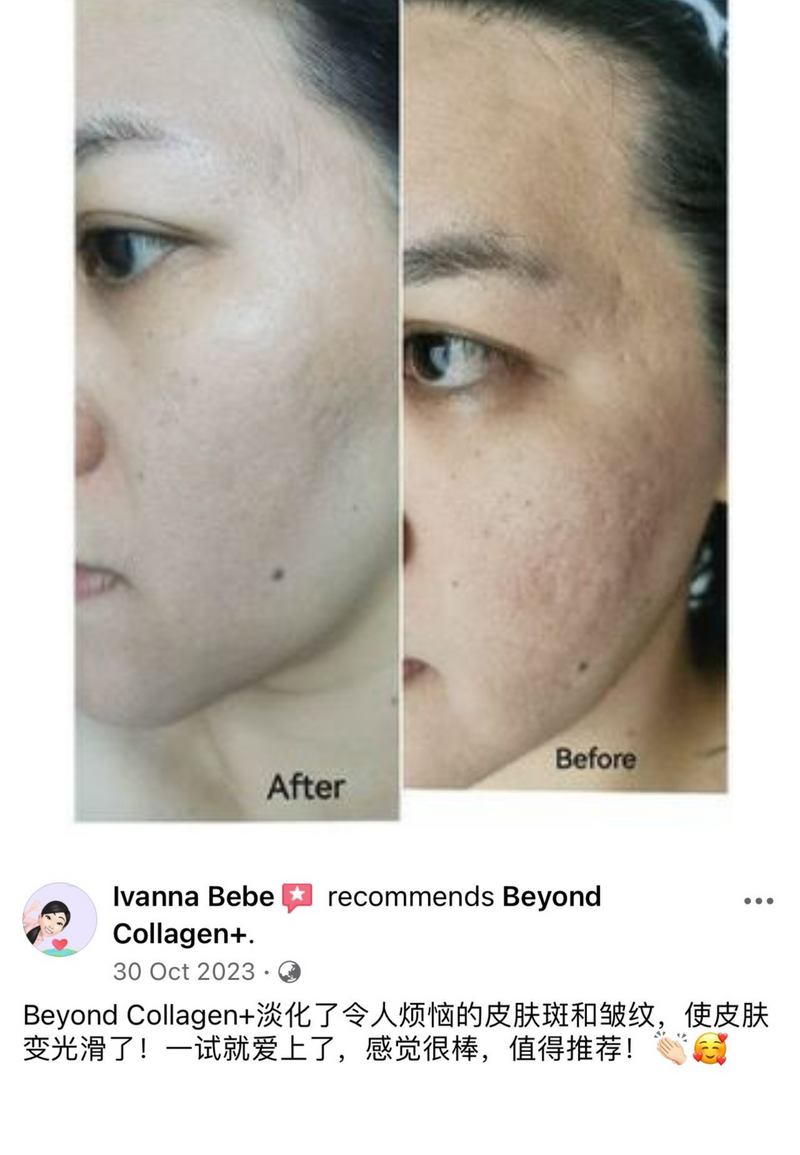 Dark Spots, Scars & Rashes — Beyond Collagen+ testimonial