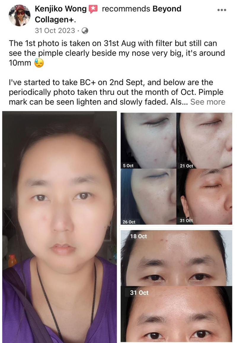 Dark Spots, Scars & Rashes — Beyond Collagen+ testimonial