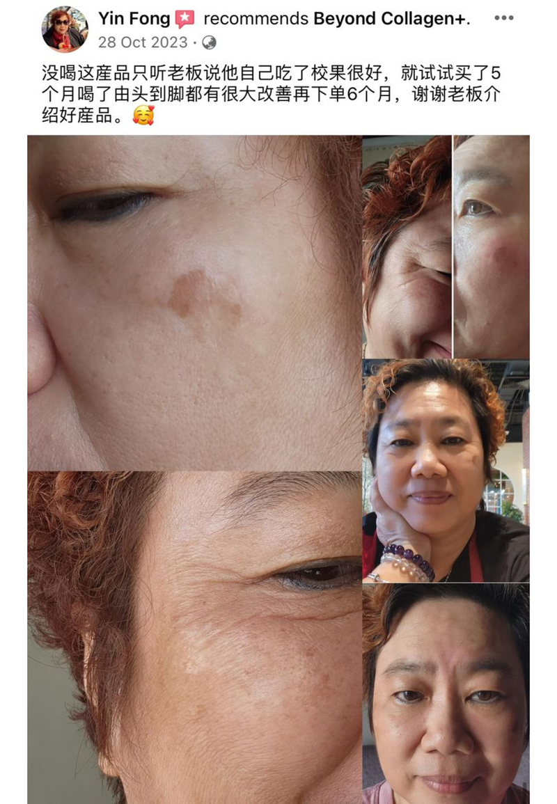 Dark Spots, Scars & Rashes — Beyond Collagen+ testimonial