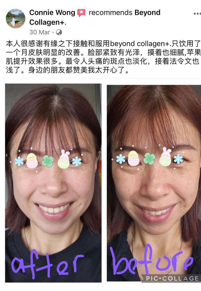 Dark Spots, Scars & Rashes — Beyond Collagen+ testimonial