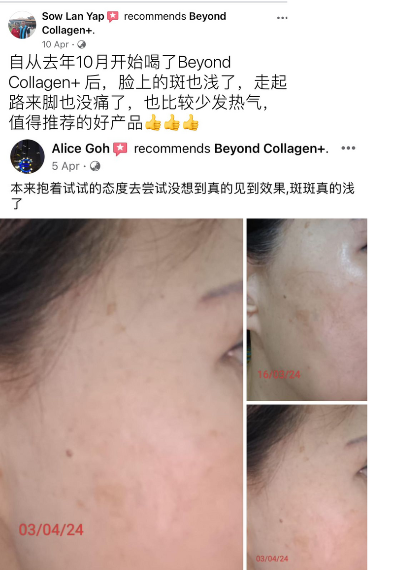 Dark Spots, Scars & Rashes — Beyond Collagen+ testimonial