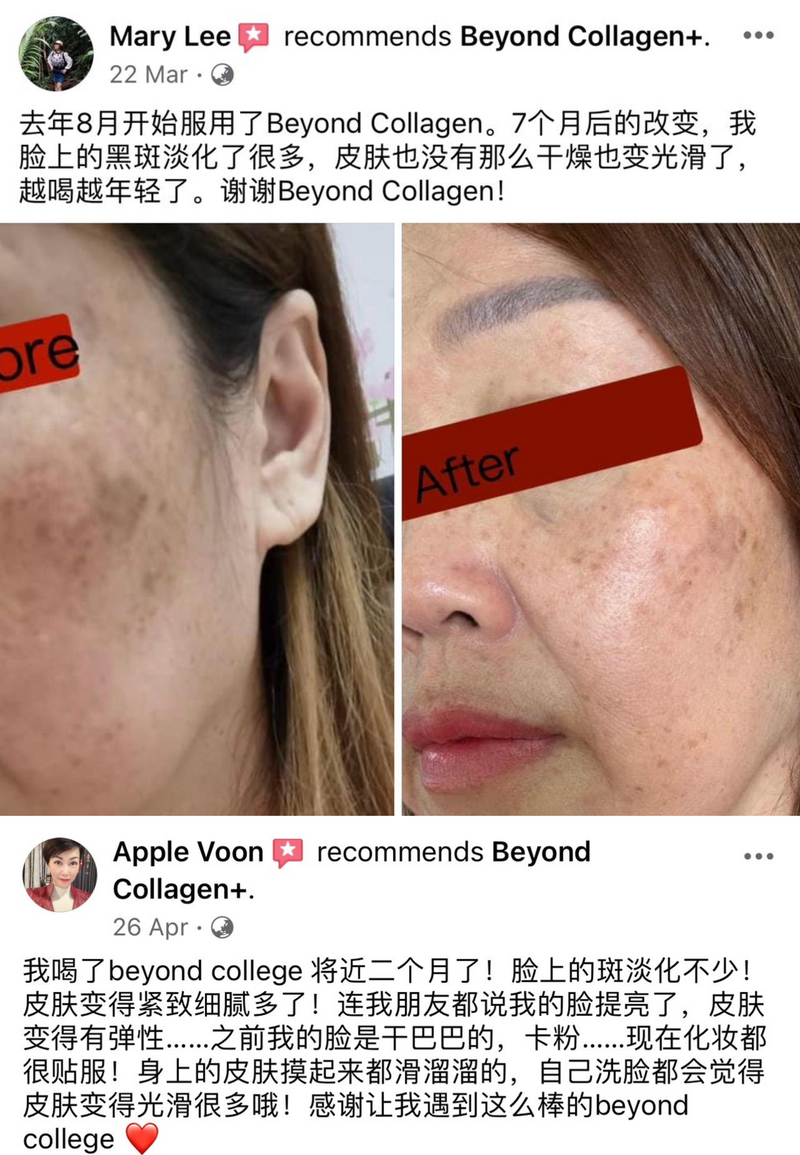 Dark Spots, Scars & Rashes — Beyond Collagen+ testimonial