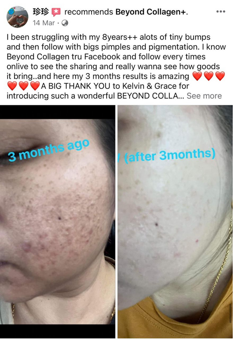 Dark Spots, Scars & Rashes — Beyond Collagen+ testimonial