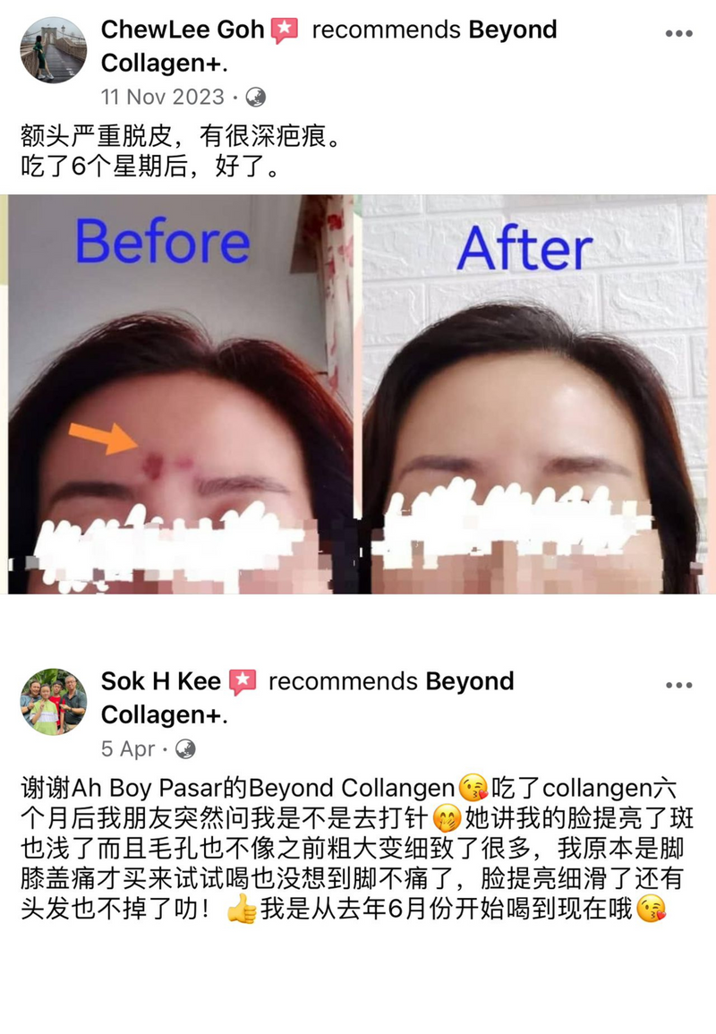 Dark Spots, Scars & Rashes — Beyond Collagen+ testimonial