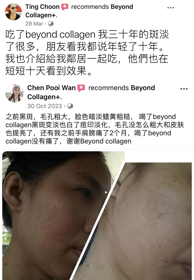 Dark Spots, Scars & Rashes — Beyond Collagen+ testimonial