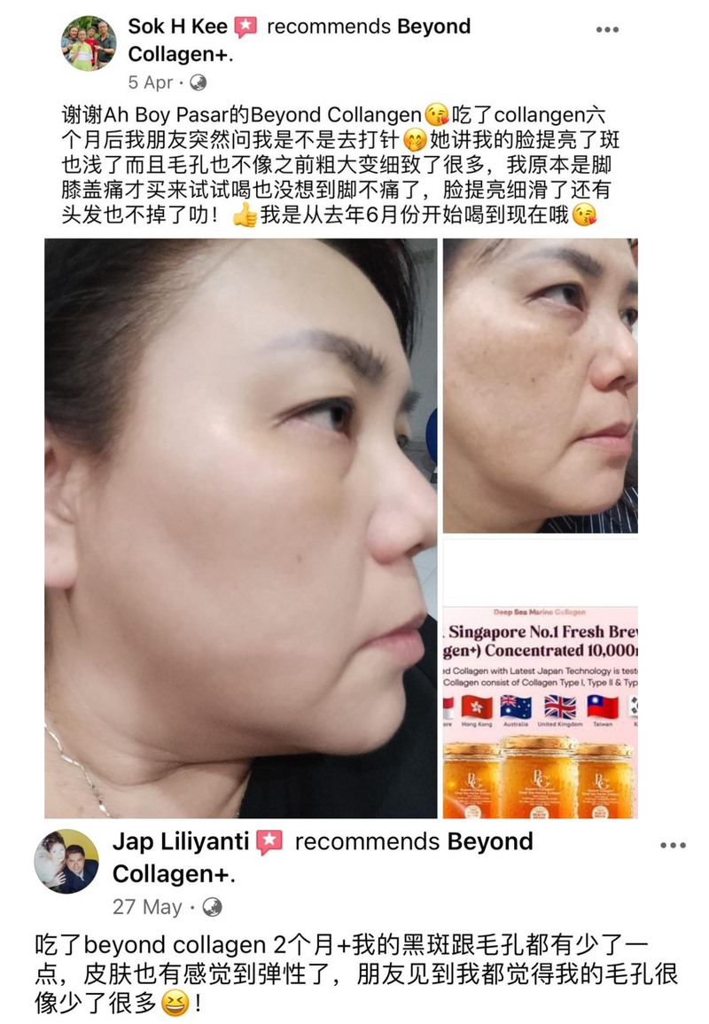 Enlarged Pores — Beyond Collagen+ testimonial