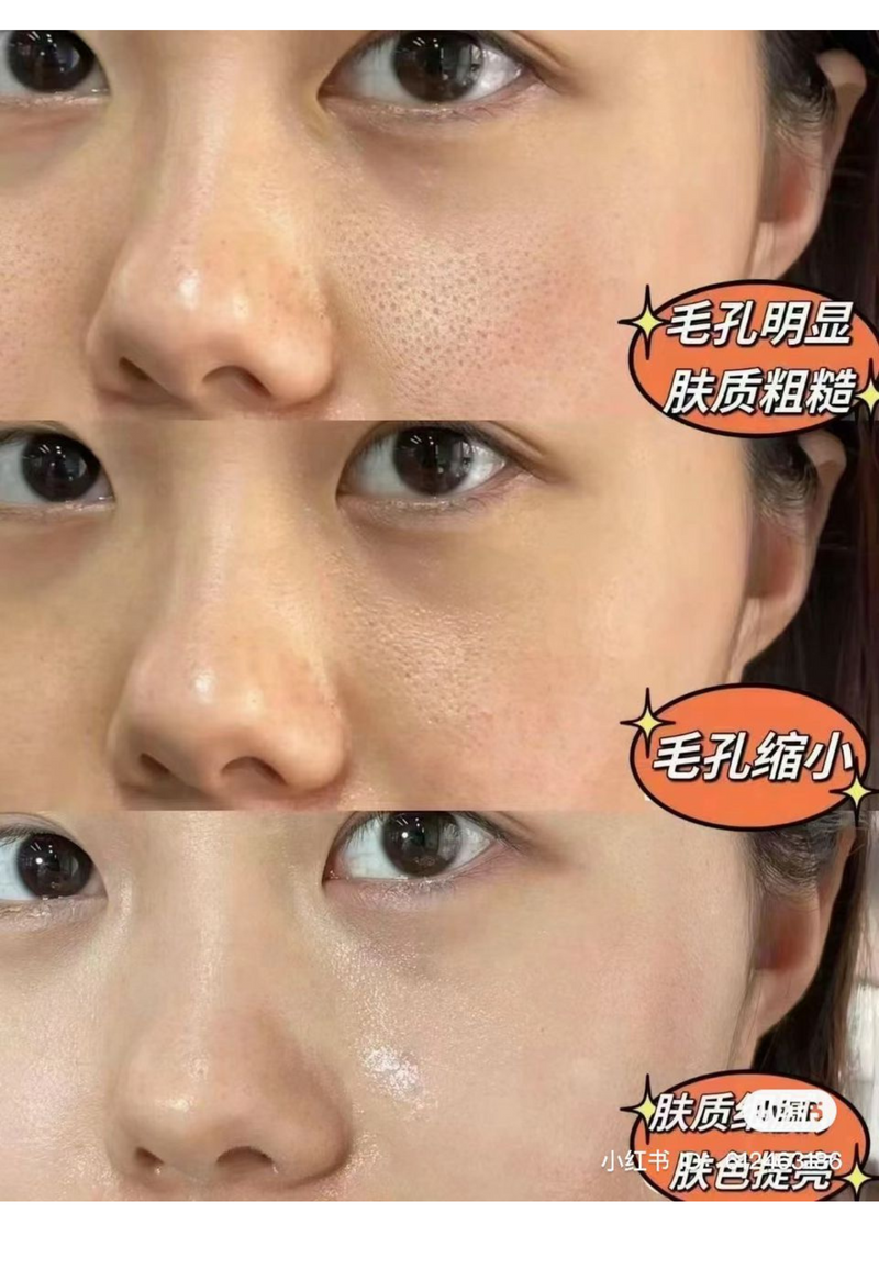 Enlarged Pores — Beyond Collagen+ testimonial