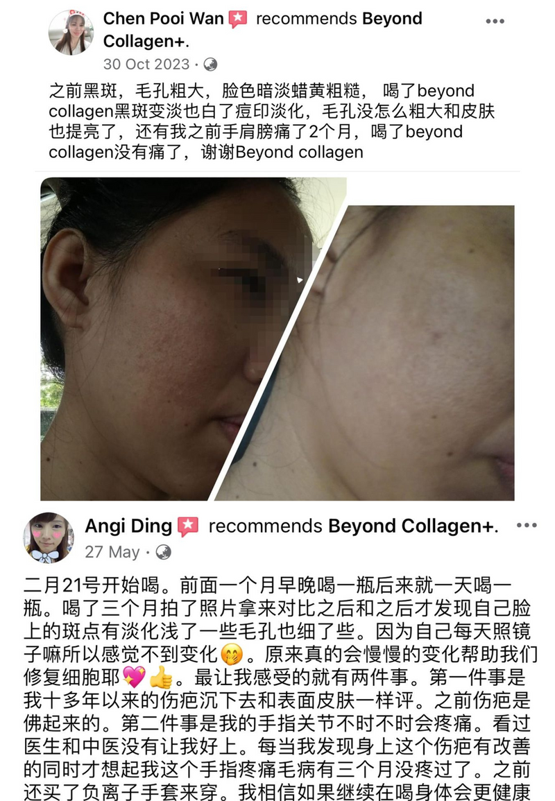 Enlarged Pores — Beyond Collagen+ testimonial