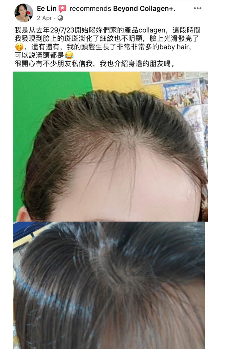 Hair Loss — Beyond Collagen+ testimonial
