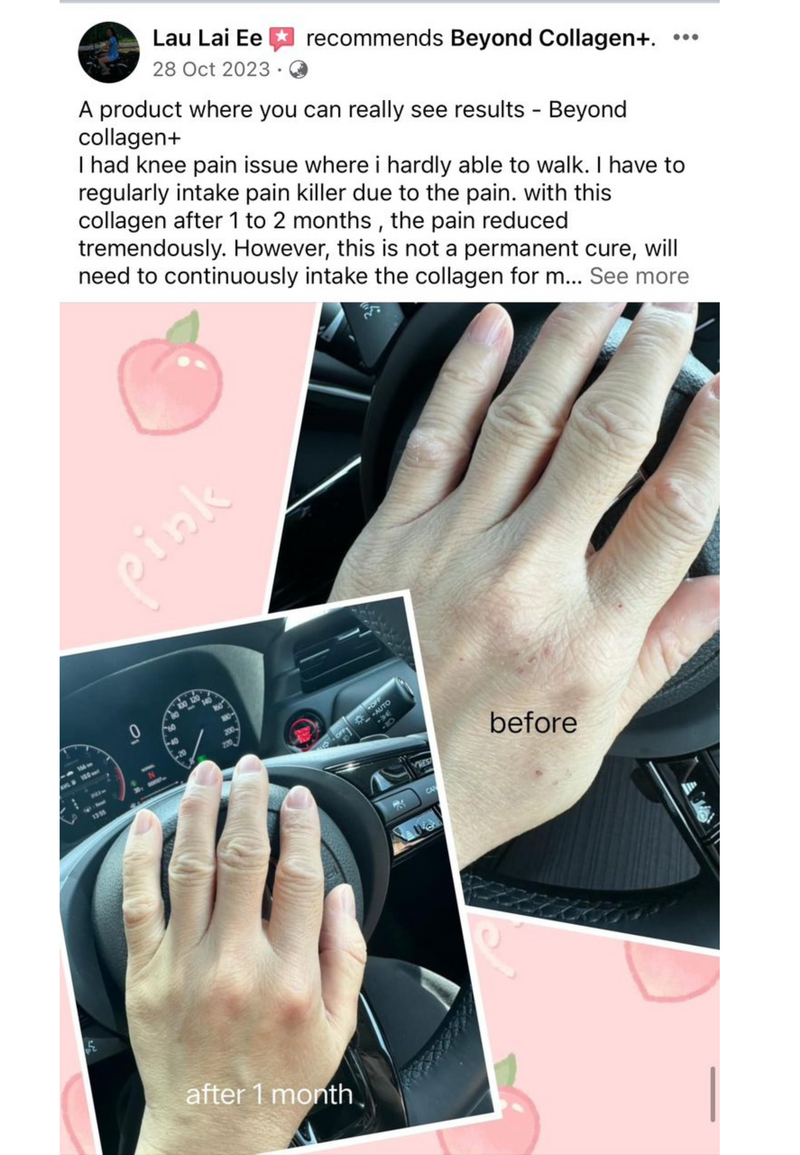 Joint Pain — Beyond Collagen+ testimonial