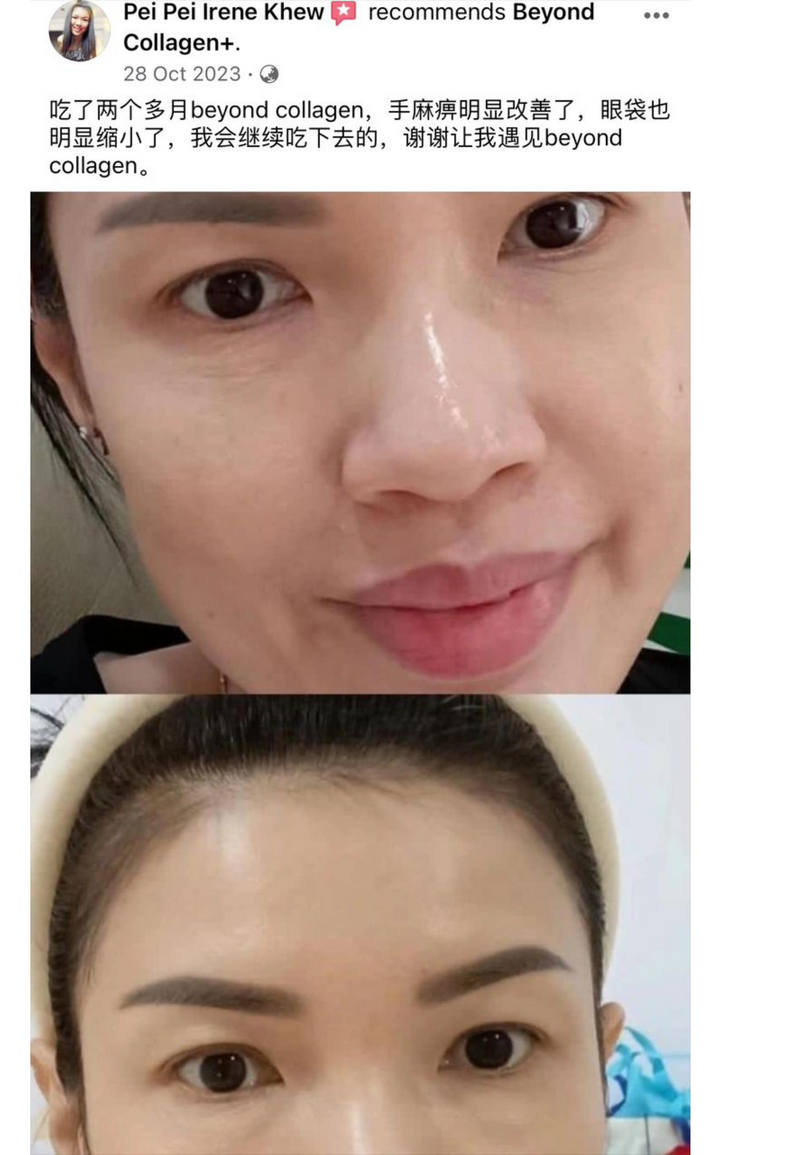 Other Transformations — Beyond Collagen+ testimonial