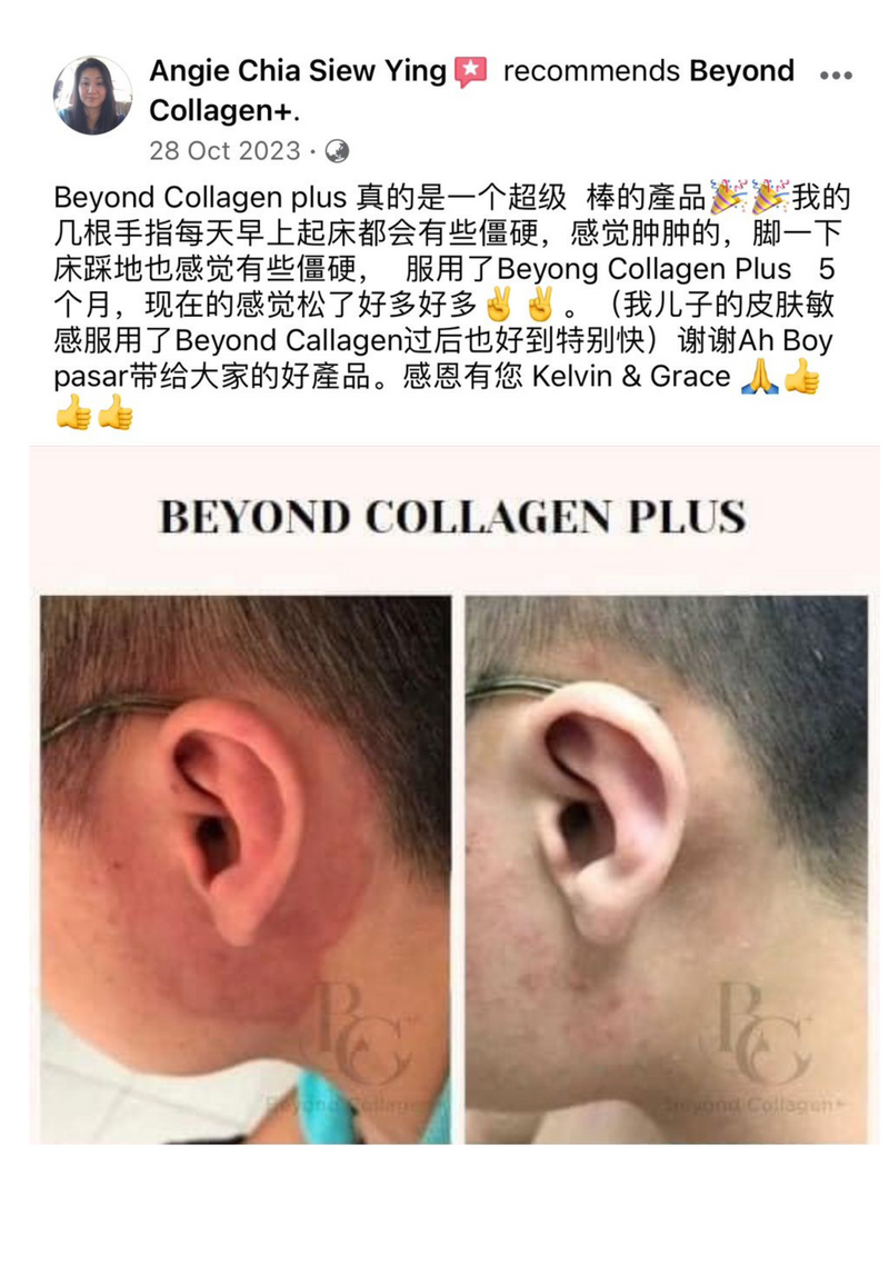 Other Transformations — Beyond Collagen+ testimonial