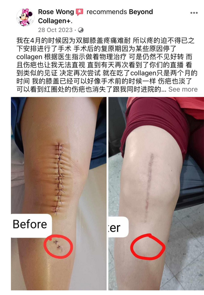 Other Transformations — Beyond Collagen+ testimonial