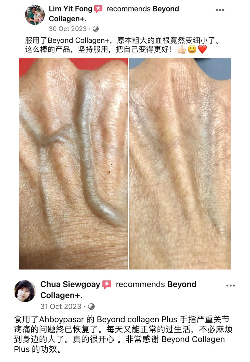 Other Transformations — Beyond Collagen+ testimonial