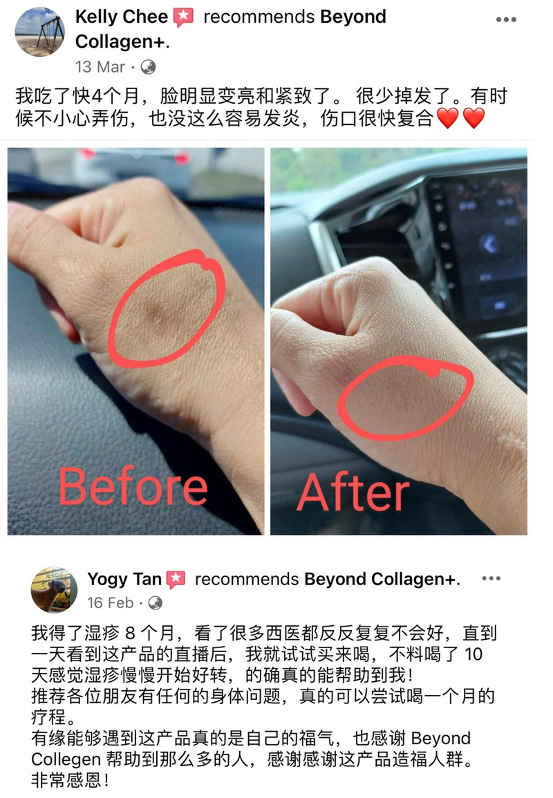 Other Transformations — Beyond Collagen+ testimonial