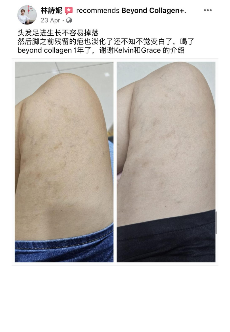 Other Transformations — Beyond Collagen+ testimonial