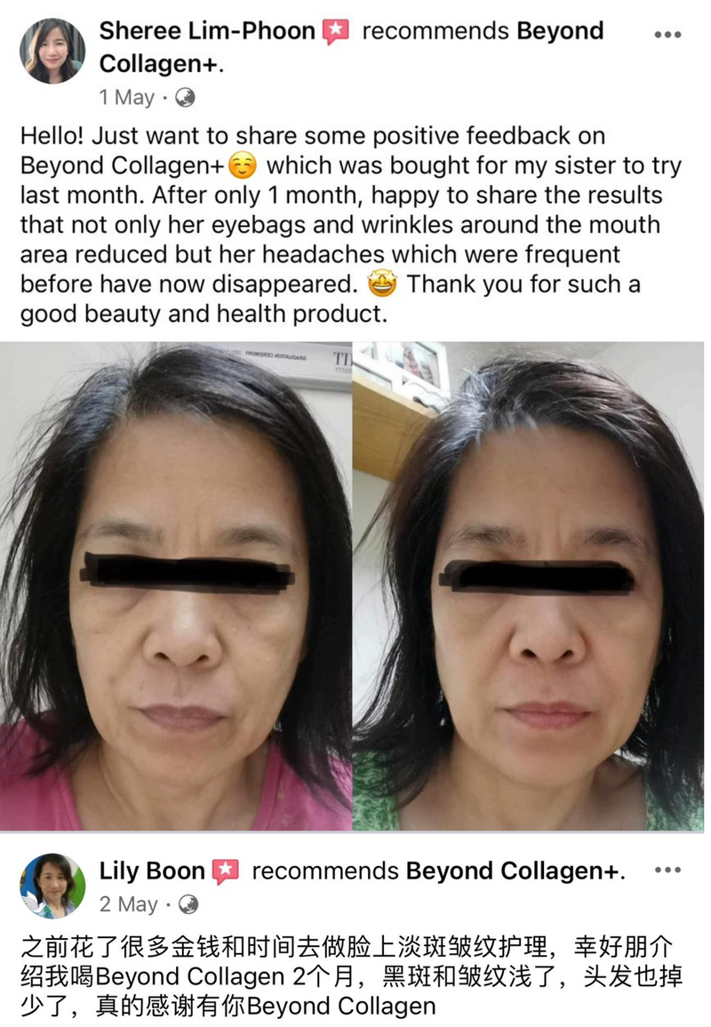 Wrinkles & Fine Lines — Beyond Collagen+ testimonial