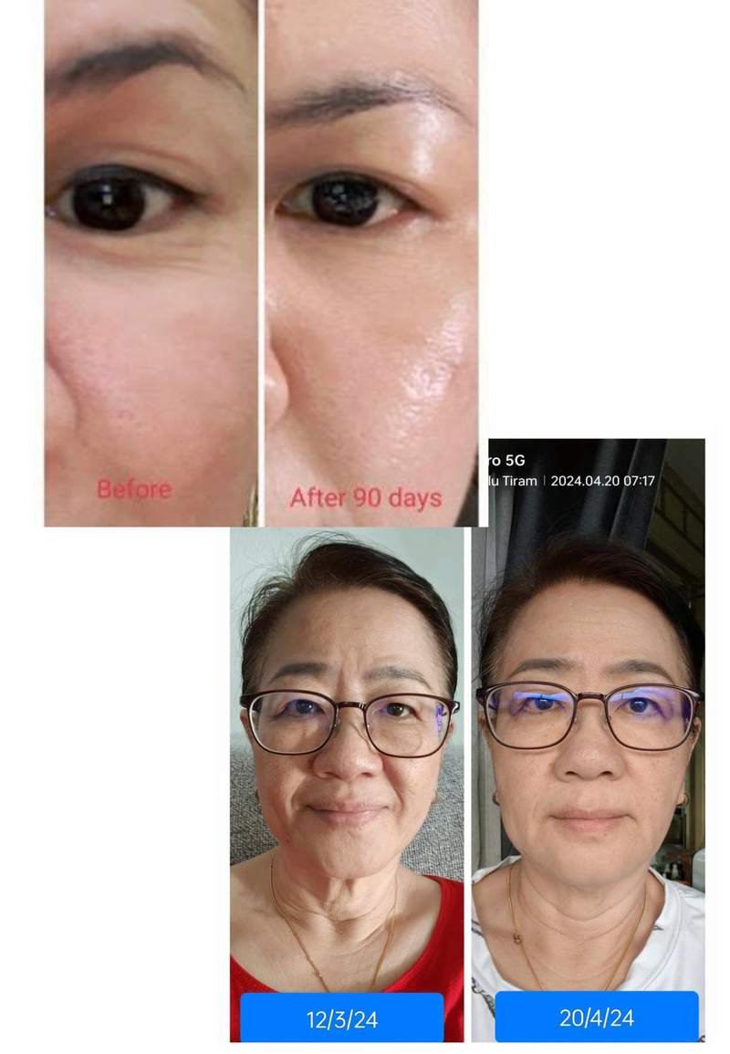 Wrinkles & Fine Lines — Beyond Collagen+ testimonial