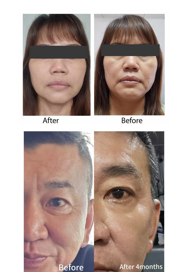 Wrinkles & Fine Lines — Beyond Collagen+ testimonial