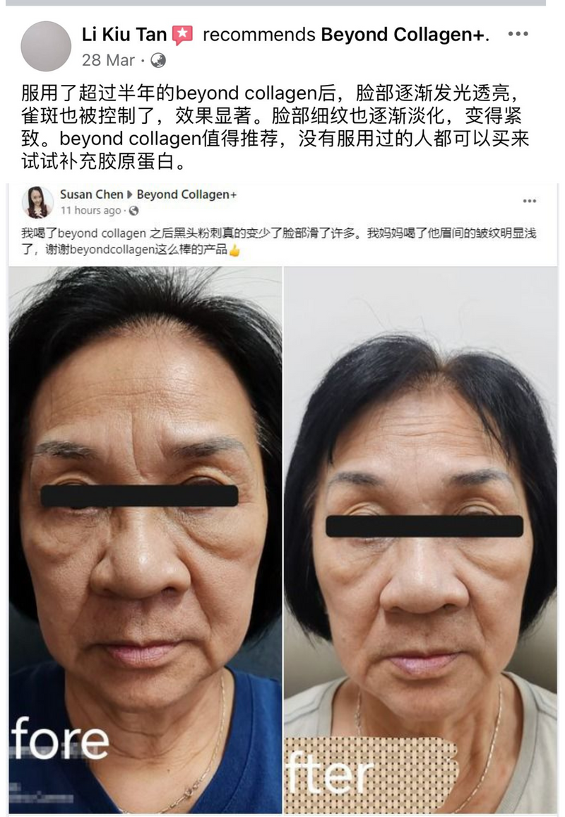 Wrinkles & Fine Lines — Beyond Collagen+ testimonial