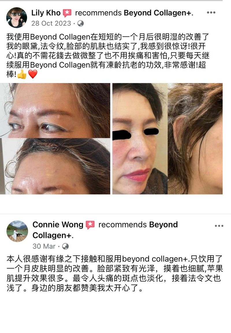 Wrinkles & Fine Lines — Beyond Collagen+ testimonial