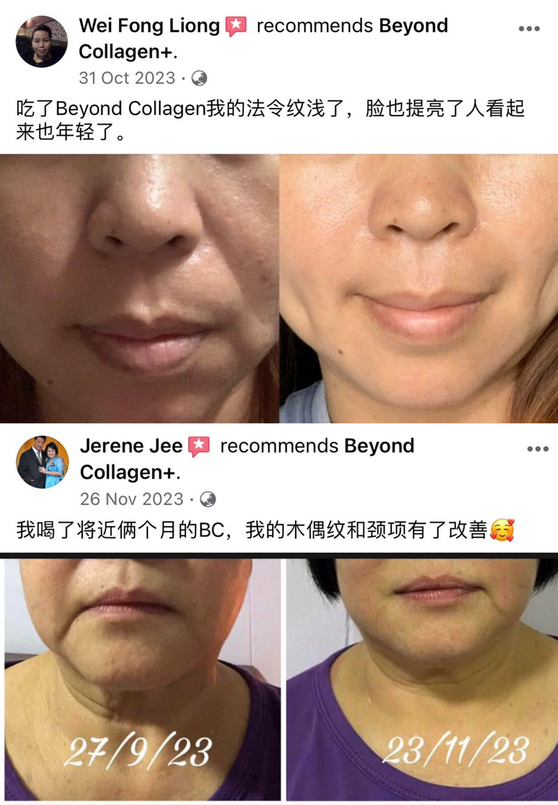 Wrinkles & Fine Lines — Beyond Collagen+ testimonial