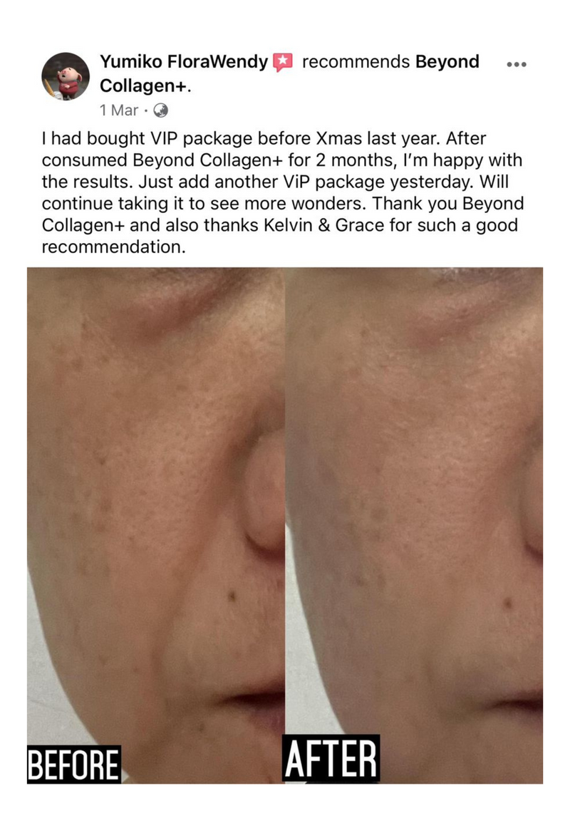 Wrinkles & Fine Lines — Beyond Collagen+ testimonial