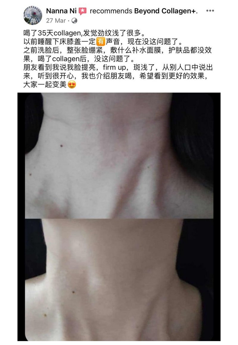 Wrinkles & Fine Lines — Beyond Collagen+ testimonial