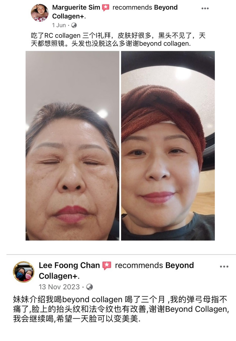 Wrinkles & Fine Lines — Beyond Collagen+ testimonial