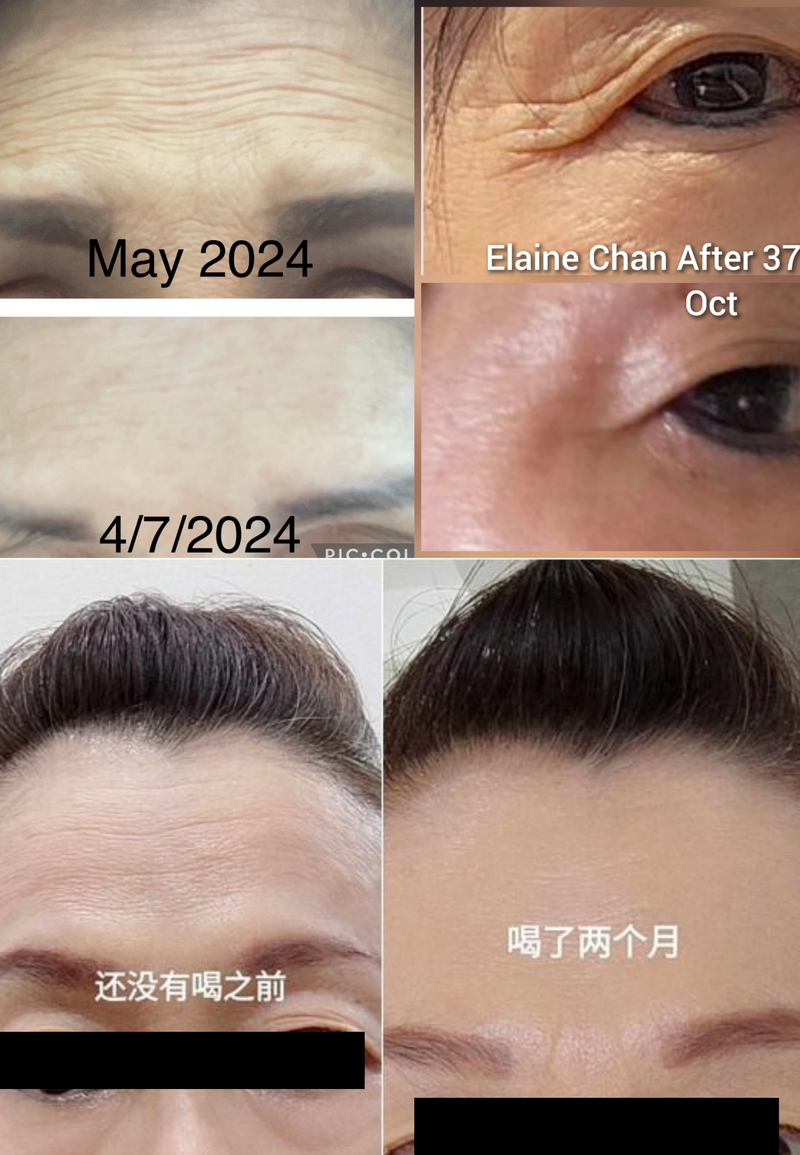 Wrinkles & Fine Lines — Beyond Collagen+ testimonial