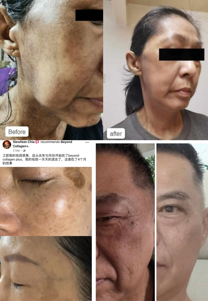 Wrinkles & Fine Lines — Beyond Collagen+ testimonial