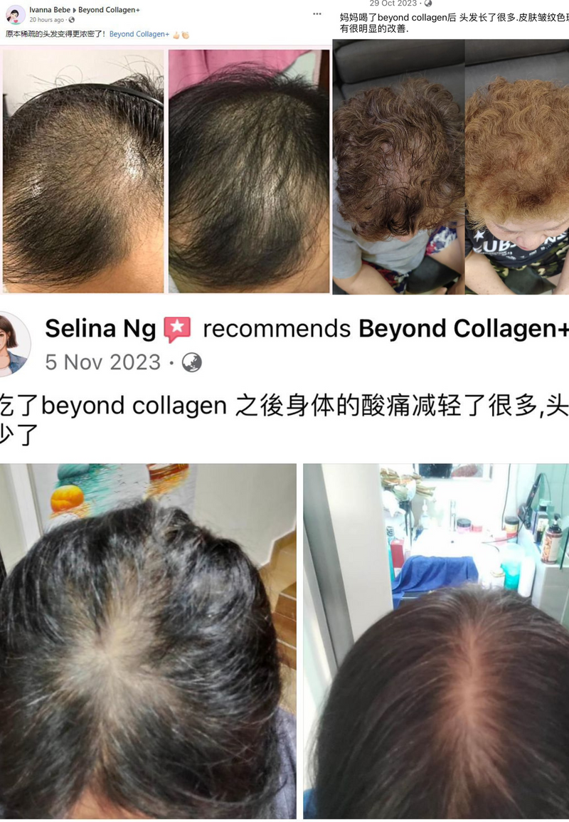 Hair Loss — Beyond Collagen+ testimonial