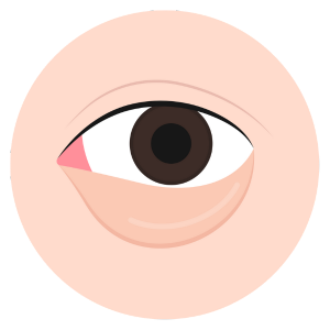 Dark Circles