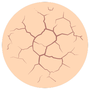 Dry Skin