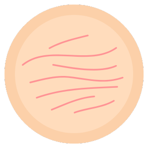 Wrinkles
